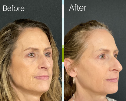 Cata-Kor - NAD+ Anti-Aging Supplement (Buy 1 Get 1 Free)